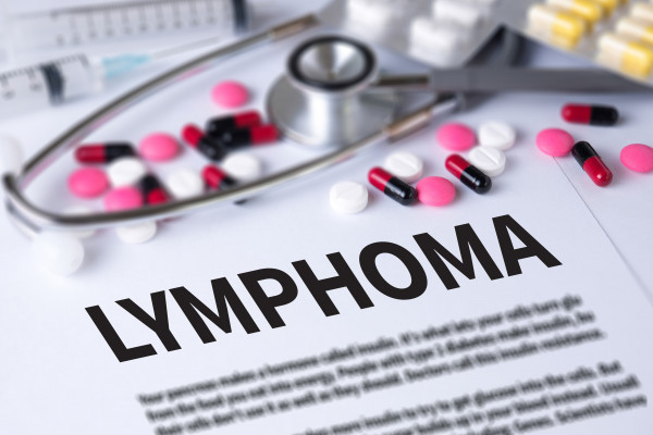 Tekutá biopsie může urychlit diagnostiku Burkittova lymfomu v rozvojových zemích